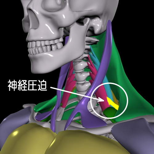 斜角筋